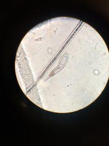 wykrywanie pasożytów - mikroskop